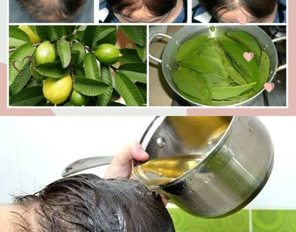 Folhas de goiabeira faz o cabelo parar de cair em